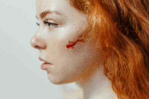 calgary relationship counselling intimate partner violence victim blood on face red haired woman